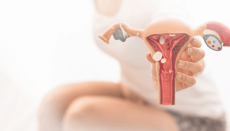 Avaliação endometrial Avaliação endometrial