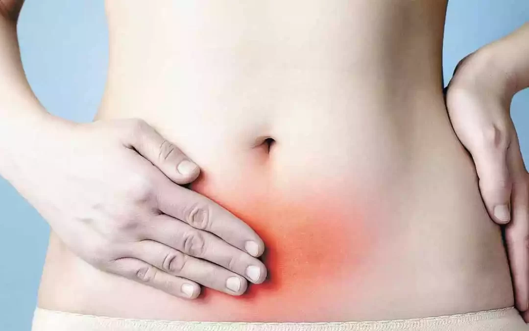 Endometriose: o que é essa doença? Endometriose: o que é essa doença?