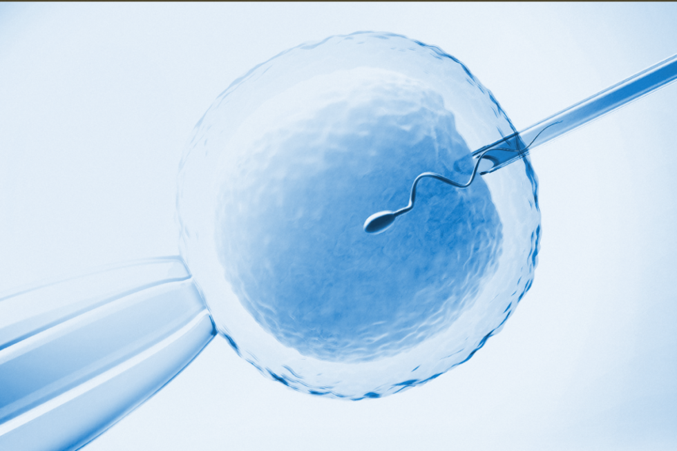 Fertilização in vitro Fertilização in vitro