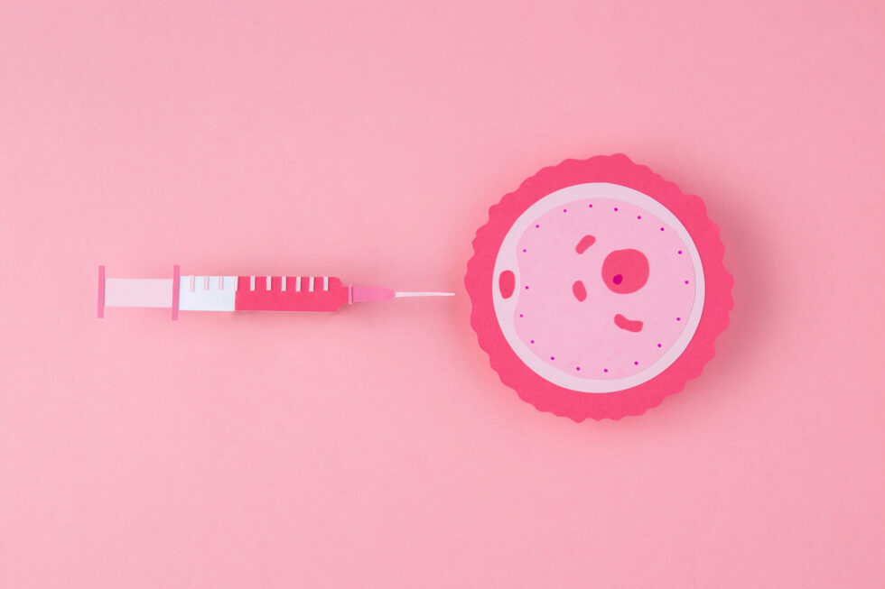Inseminação intrauterina Inseminação intrauterina