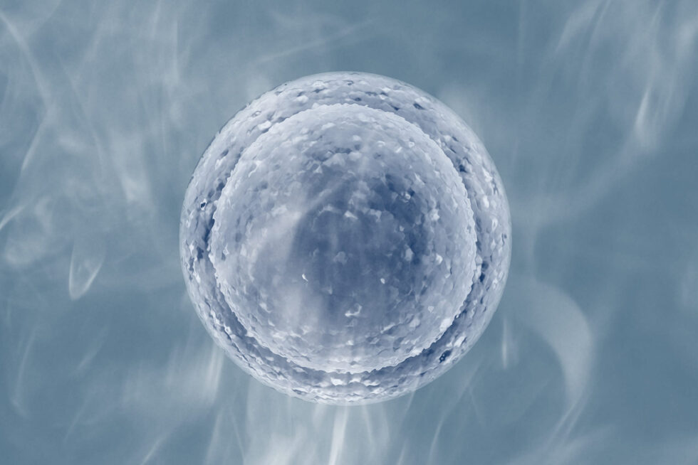 Mulheres com endometriose: congelamento de óvulos Mulheres com endometriose: congelamento de óvulos