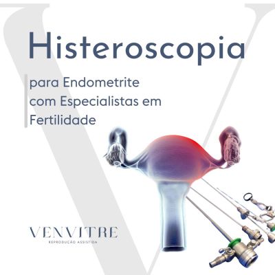 Histeroscopia Endometrite